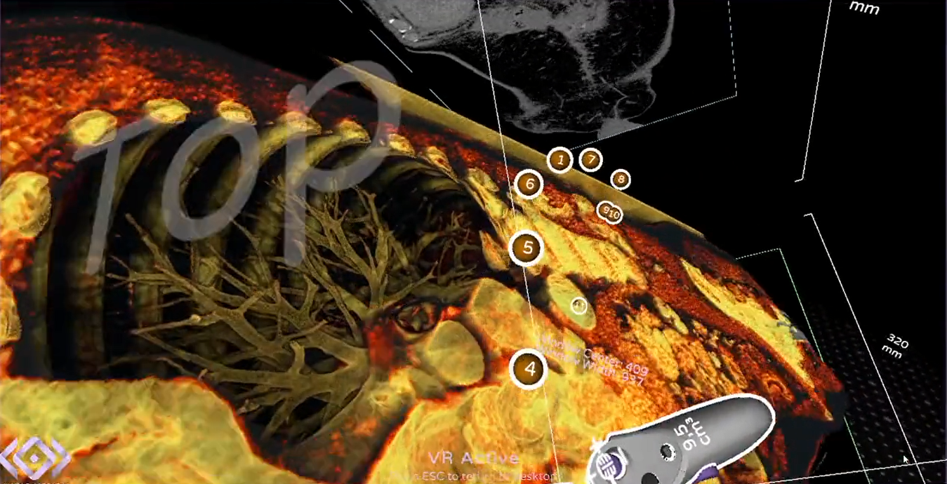 cardiovascular operation